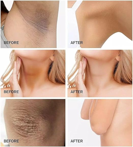 Whitening Cream For Sensitive | Private Parts